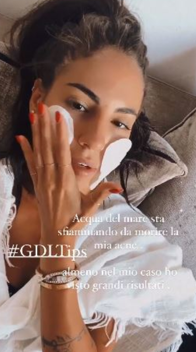 Giulia De Lellis: ecco il nuovo rimedio per la sua acne psicosomatica