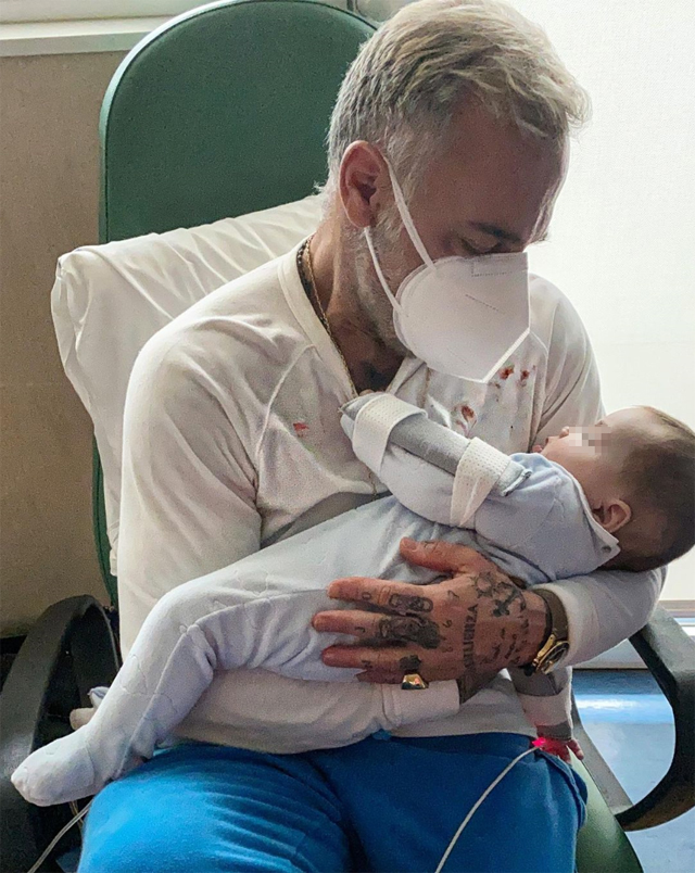 Gianluca Vacchi ha rivelato che la figlia Blu Jerusalema, che ha soli 6 mesi, si è dovuta sottoporre ad un delicato intervento chirurgico per correggere la palatoschisi