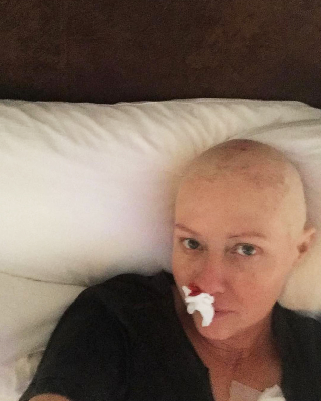 Shannen Doherty, 50 anni, ha voluto condividere l'esperienza intima del tumore al seno