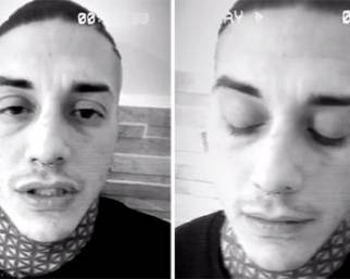 Francesco Chiofalo choc: ha un tumore al cervello