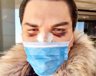 Rodrigo Alves fa un nuovo intervento