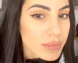 Giulia De Lellis dopo l'acne