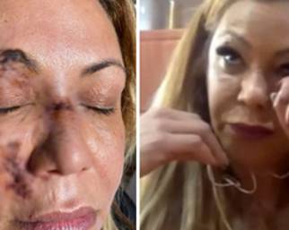 Linda Batista picchiata selvaggiamente a Dubai